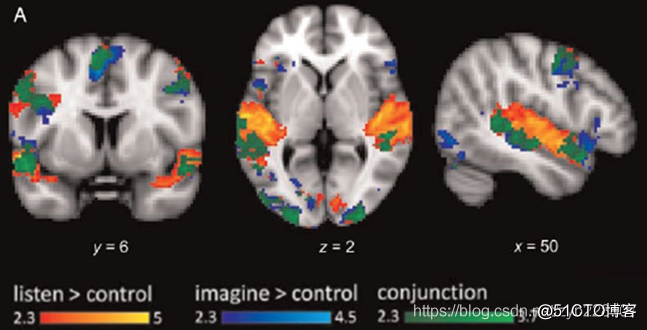 音乐倾听和回忆涉及重叠及各自独有的脑区(herholz et al 2012)