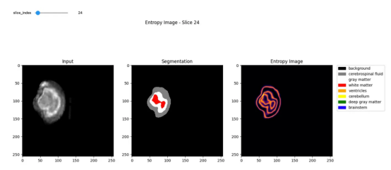 T1扫描（左），分割（中），熵（右）：作者自制图像