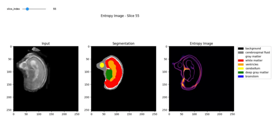 T1扫描（左），分割（中），熵（右）：作者自制图像