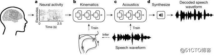 脳とコンピューターのインターフェースの分野における新たなマイルストーン：メンタルスピーチ、機械解釈